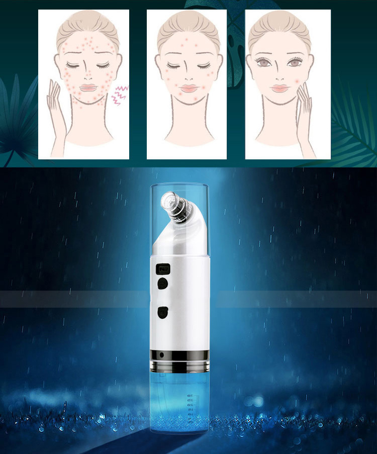 Urządzenie do oczyszczania twarzy - obrazek 2