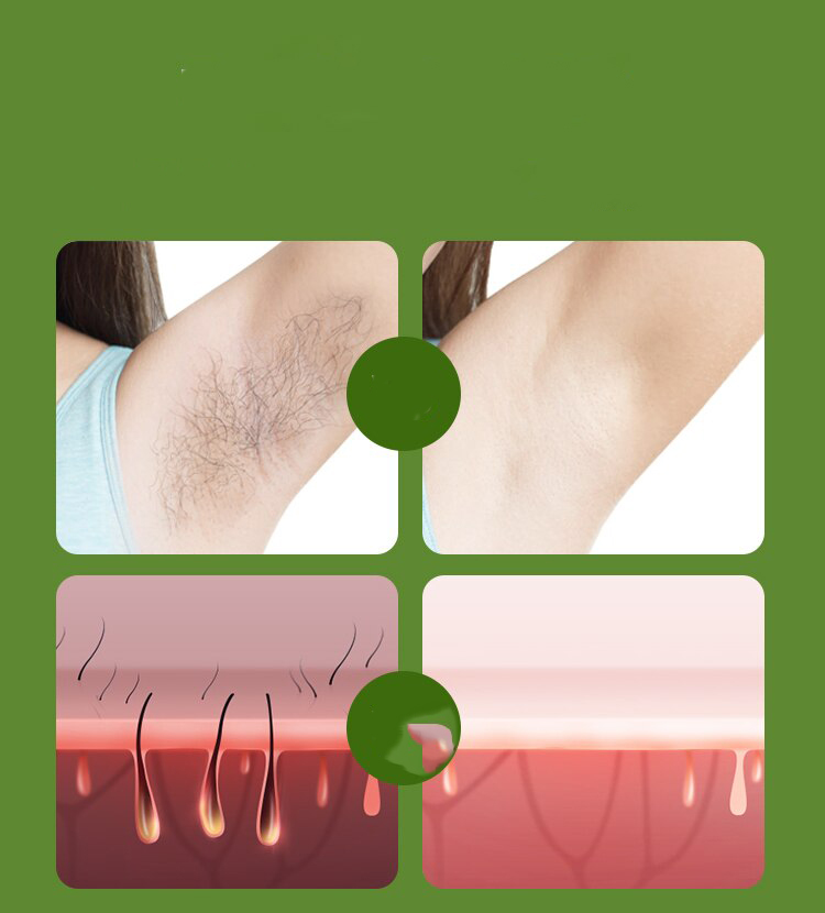 DEPILATOR LASEROWY IPL DO WŁOSÓW 4w1 - obrazek 4